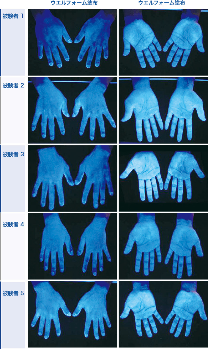 蛍光塗料を添加したウエルフォーム1.2mLを一般的な手指消毒方法に準じて手指に塗布し、 ブラックライト下で蛍光を発する部分を薬剤塗布範囲として確認しました。