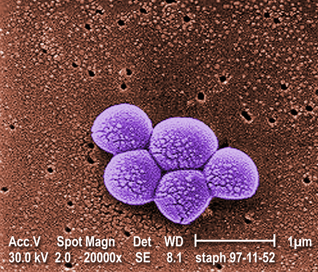 メチシリン耐性黄色ブドウ球菌(MRSA) | 丸石製薬