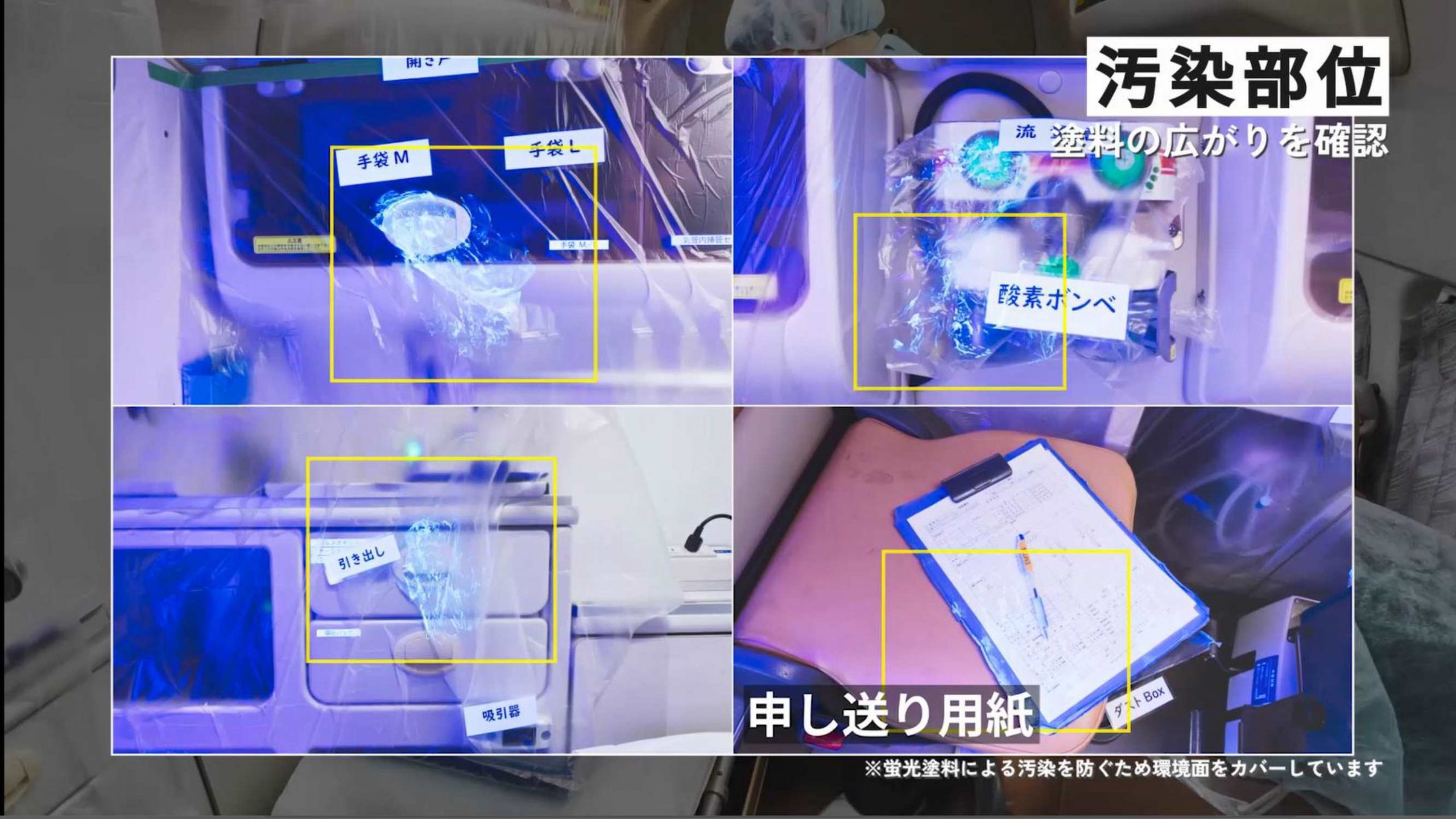 感染リスクを「視る」:救急搬送時の環境汚染